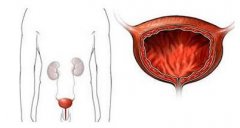  �����׵ĳ���֢״����������