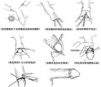 ʲôʱ����Ƥ�Ƚ��ʺ�