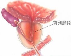 ǰ�����׵�֢״֪ʶ