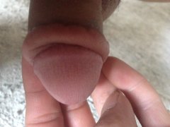 ��Ƥ��������Ҫԭ��