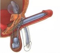 �����ЧԤ�������ϰ�