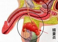 �����׵ĳ���Σ��