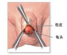 �г�������Ƥ�������к��洦