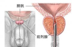 ǰ������֢�ĳ���֢״����Щ