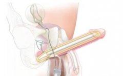 Ϊʲô���ǻỼ�в����ϰ���