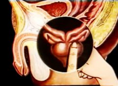 ǰ�����׵���Ҫ֢״