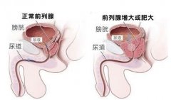 ǰ����������Σ����������